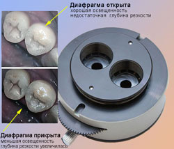микроскоп операционный стоматологический